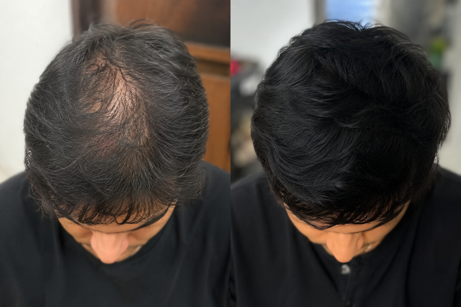 Two crown photographs of the same person taken at different times, shown as an example of consistent progress documentation